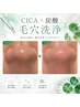 【ニキビ肌、思春期の過剰な皮脂に毛穴洗浄】炭酸×CICA育つ素肌 学生¥5,000