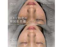 ディアー(Dear)