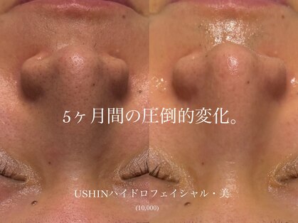 ユウシン 心斎橋(USHIN)の写真