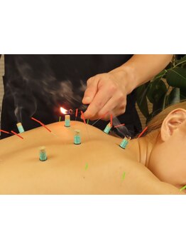 鍼灸施術を受けたい