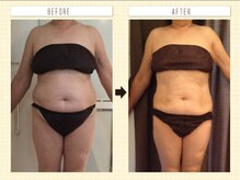 ウェリナ平和堂長久手院/小顔矯正/骨盤矯正/美脚サロン