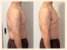 ラフリー 仙台院(RUFFREE)/肩こり改善に肩甲骨はがし