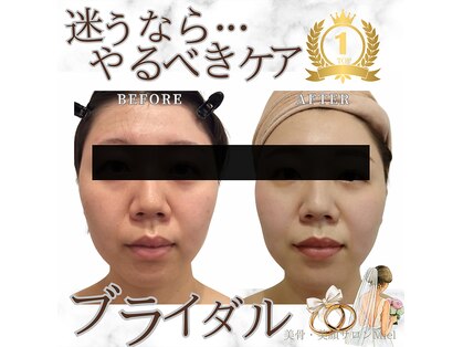 ミエル(Miel)の写真