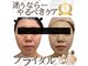 ミエル(Miel)の写真