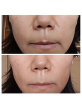 ル リアン(soins de visage Le lien)/白珠物語の効果♪