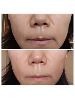 ル リアン(soins de visage Le lien)/白珠物語の効果♪