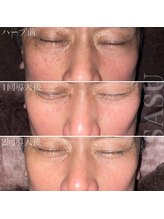 サス(SASU)/継続は力なり♪長年のお悩み改善