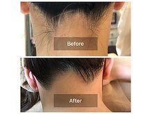 エステ ドゥ フローラの雰囲気（【都度払い】大人気の光脱毛　うなじコースで後ろ姿美人に☆）