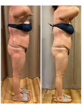 スピード美人 横浜店/食事制限なしでも痩せれます