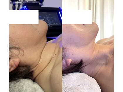 ヴェリー(VARY)の写真