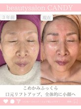 ビューティーサロン キャンディ 海老名(Candy)/