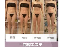 メルローズ 自由が丘店(Melrose)/【お客様の効果写真】