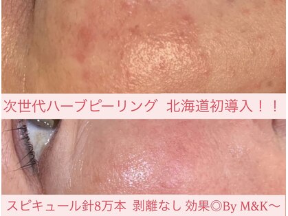 エム アンド ケー(M&K)の写真
