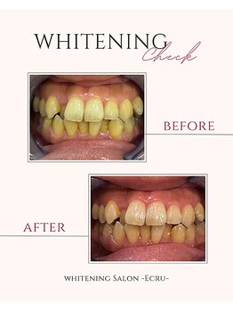 エクリュ(Ecru)/Before→After