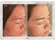 ベル 新橋(Belle)