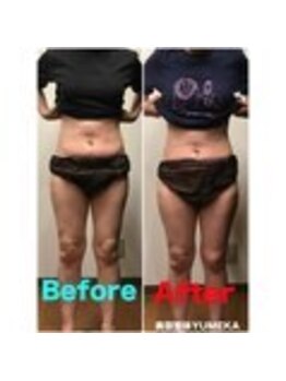 ユメカ 日の出院(YUMEKA)/骨盤ダイエット+骨盤ストレッチ