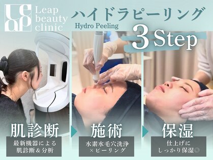 リープ(Leap)の写真