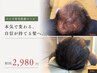 【メンズ育毛促進コース】カウンセリング11000→2980円