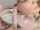 コマ(KOMA)の写真/【ニキビ改善 /完全オーダーメイドハーブ】結果重視×1人ひとりに寄り添った本気の根本肌質改善ケア◎
