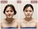 リシュレータ(RISYURE-TA)の写真