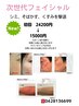 期間限定　new次世代光フェイシャル
