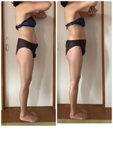 ティアラ/特別な日の前日ケアぴったり♪