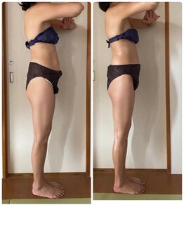 ティアラ/特別な日の前日ケアぴったり♪