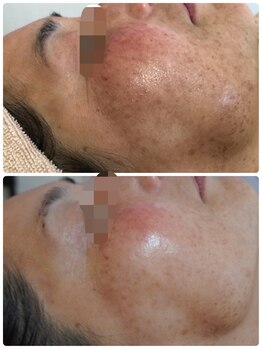 リバージュ(Riverge)/