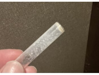 エステティックサロン キュビア(Cubia)/鼻の汚れがこんなに取れました！