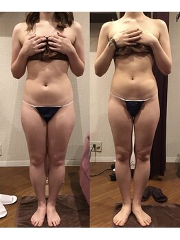 エスプレッソ(espresso,)/【全身痩身10回】お腹-7.5cm