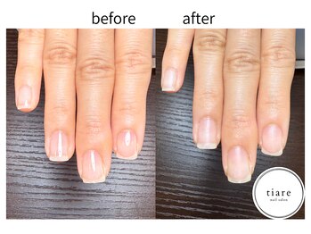 ティアレ(tiare)/施術例