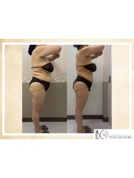 サイズダウンを目指したい