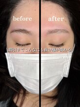 ドース(DOSE)/眉毛垢抜け大作戦