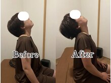 黒田鍼灸治療院/全身から整える美容鍼