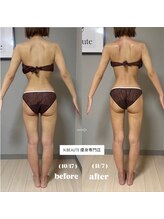 エヌボーテ(N. beaute)/全身痩身モニターコース