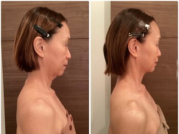 ココ 広島店(COCO)/50代　顔肩凝り