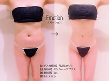 エモーション 自由が丘店(Emotion)