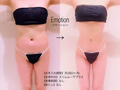 エモーション 自由が丘店(Emotion)の写真