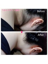 ルアナ(Luana)/うなじ脱毛で見た目の印象変える