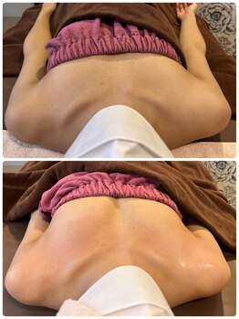 ロココ 豊田店(Rococo)/ビフォーアフター