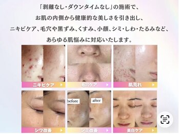 ホワイトアクア 四日市店(WHITE AQUA)/肌管理専門店だからこそ結果重視