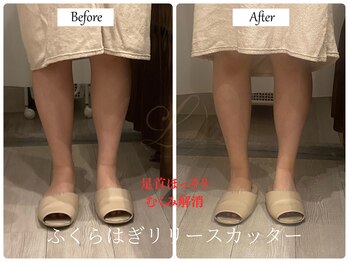 リノ(Lino)/下半身リリースカッター
