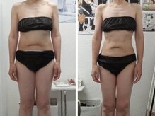 50代,6か月24回(90分)＝－10kg★痩身ダイエット＋真菰蒸し等