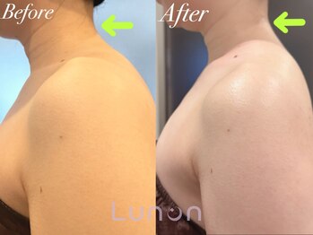 ルノン(Lunon)/【巻き肩・肩こり】肩甲骨はがし