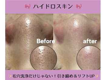 サロンリアンジュ ひたちなか店(Salon Liange)/【毛穴洗浄◇引き締めまで◎】