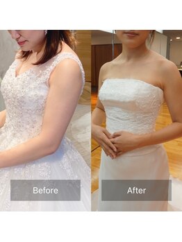 ベルミア(Bellemia)/ブライダルエステ