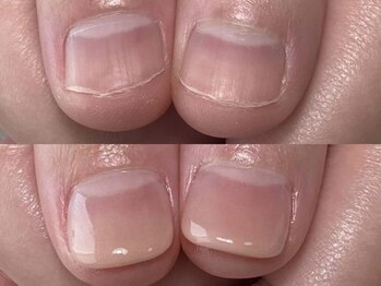 ポメロ(POMELO)の写真/爪周りの余分な角質除去で”ツルスベな指先”とツヤ感アップ!ホームケアとの継続で縦長美爪へと嬉しい変化!