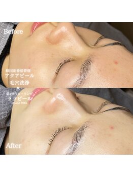 リル 和歌山市店(lilou)/ララピールで透明感UP☆