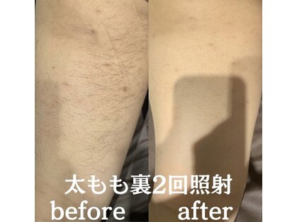 モア男子(MORE男子)の写真