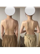 カシェット(cachette)/ブライダルエステ